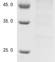 Mouse 5-AMP-activated protein kinase catalytic subunit alpha-1 (Prkaa1) Recombinant Protein - BioCrest Sci