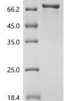 Mumps virus Nucleoprotein (N) Recombinant Protein - BioCrest Sci