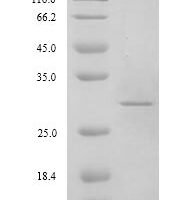 Hepatitis E virus genotype 3 Pro-secreted protein ORF2(ORF2), partial Recombinant Protein, N-His - BioCrest Sci