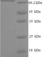 Human PC4 and SFRS1-interacting protein (PSIP1) Recombinant Protein - BioCrest Sci