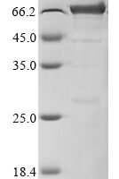Human Insulin-like growth factor 1 receptor (IGF1R), partial,Biotinylated Recombinant Protein - BioCrest Sci