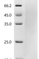 Dog Parathyroid hormone/parathyroid hormone-related peptide receptor (PTH1R), partial Recombinant Protein, C-His, aa 27–188, Yeast - BioCrest Sci
