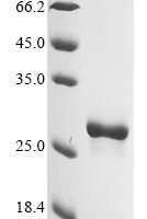 Human Hypoxanthine-guanine phosphoribosyltransferase (HPRT1) Recombinant Protein, C-His - BioCrest Sci