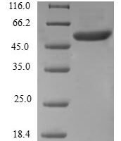 Human Ras-related protein Rab-5B (RAB5B) Recombinant Protein - BioCrest Sci