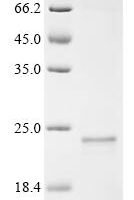 Clostridium botulinum C phage Hemagglutinin components HA-70 type C (HA-70) Recombinant Protein - BioCrest Sci