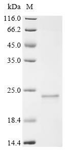 Clostridium botulinum C phage Hemagglutinin components HA-70 type C (HA-70) Recombinant Protein, Clostridium botulinum C phage (Clostridium botulinum C bacteriophage), Yeast, C-terminal 6xHis-tagged, 22.4 kDa, purity >≥ 85% as determined by SDS-PAGE.