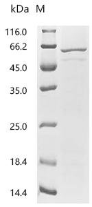 Human Cerebellar degeneration-related protein 2(CDR2) Recombinant Protein, Homo sapiens (Human), Baculovirus, C-terminal 6xHis-tagged, 55.3 kDa, purity >≥ 85% as determined by SDS-PAGE.