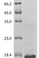 Mouse Endothelin-2 (Edn2), partial Recombinant Protein, N-His/C-His - BioCrest Sci