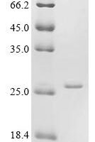 Neisseria gonorrhoeae Ribonuclease H (rnhA) Recombinant Protein - BioCrest Sci