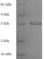 Human Protein Mpv17 (MPV17) Recombinant Protein - BioCrest Sci