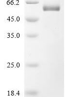 Human Semenogelin-1 (SEMG1) Recombinant Protein - BioCrest Sci