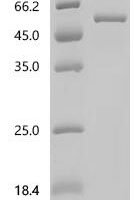 Human S-phase kinase-associated protein 2 (SKP2) Recombinant Protein, C-His - BioCrest Sci