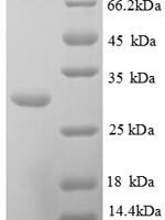Human Kallikrein-10 (KLK10), partial Recombinant Protein - BioCrest Sci