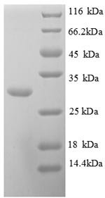 Human Kallikrein-10 (KLK10), partial Recombinant Protein, Homo sapiens (Human), E.coli, N-terminal 6xHis-tagged, 30.8 kDa, purity >≥ 90% as determined by SDS-PAGE.
