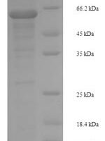 Human Mitogen-activated protein kinase 9 (MAPK9) Recombinant Protein - BioCrest Sci