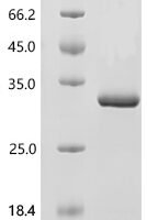 Human Serotonin N-acetyltransferase (AANAT) Recombinant Protein - BioCrest Sci
