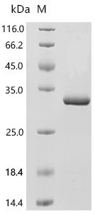 Human Serotonin N-acetyltransferase (AANAT) Recombinant Protein, Homo sapiens (Human), E.coli, C-terminal 6xHis-tagged, 30.3 kDa, purity >≥ 90% as determined by SDS-PAGE.