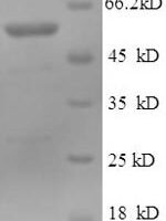 Human Cytosolic 5'-nucleotidase 1A (NT5C1A) Recombinant Protein - BioCrest Sci
