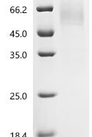 Macaca fascicularis Parathyroid hormone/parathyroid hormone-related peptide receptor (PTH1R), partial Recombinant Protein - BioCrest Sci