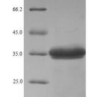 Staphylococcus aureus Gamma-hemolysin component C (hlgC) Recombinant Protein, N-His - BioCrest Sci