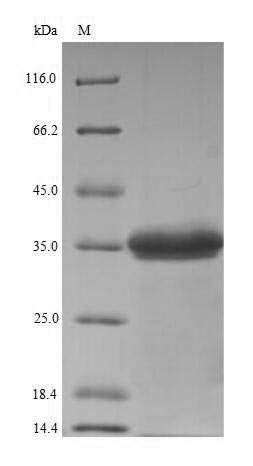 Staphylococcus aureus Gamma-hemolysin component C (hlgC) Recombinant Protein, N-His, Staphylococcus aureus (strain N315), E.coli, N-terminal 6xHis-tagged, 36.6 kDa, purity >≥ 85% as determined by SDS-PAGE.