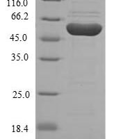 Human Homogentisate 1,2-dioxygenase (HGD) Recombinant Protein - BioCrest Sci