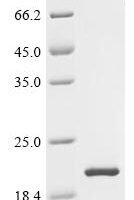 Rat Forkhead box protein D3 (Foxd3) Recombinant Protein - BioCrest Sci