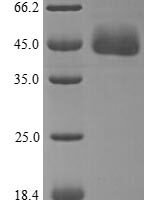 Human Apolipoprotein A-IV (APOA4) Recombinant Protein - BioCrest Sci