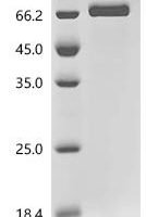 Human Protein HEXIM1 (HEXIM1) Recombinant Protein, C-10His - BioCrest Sci