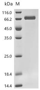 Human Protein HEXIM1 (HEXIM1) Recombinant Protein, C-10His, Homo sapiens (Human), Mammalian cell, C-terminal 10xHis-tagged, 42.0 kDa, purity >≥ 95% as determined by SDS-PAGE.