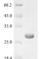 Haemophilus influenzae 50S ribosomal protein L4 (rplD) Recombinant Protein - BioCrest Sci