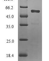 Human Fibronectin type 3 and ankyrin repeat domains protein 1 (FANK1) Recombinant Protein - BioCrest Sci