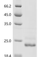 Chlamydia pneumoniae Large cysteine-rich periplasmic protein OmcB (omcB), partial Recombinant Protein - BioCrest Sci