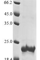 Rat TGF-beta receptor type-2 (Tgfbr2), partial Recombinant Protein - BioCrest Sci