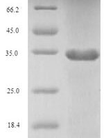Human Fibroblast growth factor 10 (FGF10), partial Recombinant Protein, N-His-SUMO, aa 41–208 - BioCrest Sci