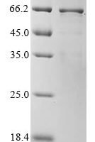 Arachis hypogaea Allergen Arachin Arah3 isoform Recombinant Protein - BioCrest Sci