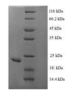 Bordetella pertussis Serotype 2 fimbrial subunit (fim2) Recombinant Protein, N-His, aa 27–207, E.coli - BioCrest Sci