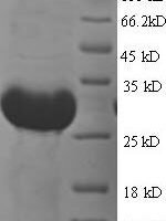Escherichia coli Vitamin B12-binding protein (btuF), partial Recombinant Protein, N-His - BioCrest Sci