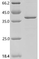 Human Interleukin-33 (IL33) Recombinant Protein - BioCrest Sci