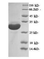 Mouse Macrosialin (Cd68), partial Recombinant Protein, N-His - BioCrest Sci