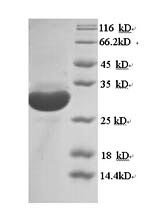 Mouse Macrosialin (Cd68), partial Recombinant Protein, N-His, Mus musculus (Mouse), Yeast, N-terminal 6xHis-tagged, 30.8 kDa, purity >≥ 90% as determined by SDS-PAGE.
