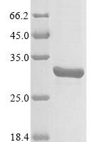Escherichia coli O157:H7 NADH pyrophosphatase (nudC) Recombinant Protein - BioCrest Sci