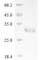Horse Creatine kinase (CKM), partial Recombinant Protein - BioCrest Sci