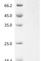 Mouse Nucleolar RNA helicase 2 (Ddx21) Recombinant Protein, N-His - BioCrest Sci