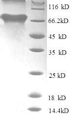Human TAR DNA-binding protein 43 (TARDBP), partial Recombinant Protein, N-GST, Homo sapiens (Human), E.coli, N-terminal GST-tagged, 69.9 kDa, purity >≥ 90% as determined by SDS-PAGE.