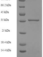 Human 39S ribosomal protein L11, mitochondrial (MRPL11), partial Recombinant Protein - BioCrest Sci