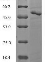 Candida glabrata Serine/threonine-protein kinase ATG1 (ATG1), partial Recombinant Protein, N-His-SUMO - BioCrest Sci