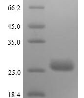 Rabies virus Matrix protein (M) Recombinant Protein, N-10His/C-Myc - BioCrest Sci
