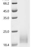 Human NADH dehydrogenase [ubiquinone] iron-sulfur protein 6, mitochondrial（NDUFS6) Recombinant Protein, N-His - BioCrest Sci