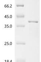 Streptococcus agalactiae serotype V Phosphate import ATP-binding protein PstB 2 (pstB2) Recombinant Protein - BioCrest Sci